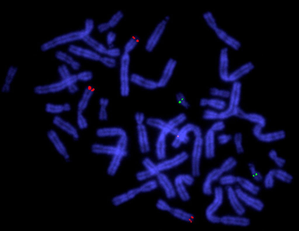 Chromosomen in der Metaphase