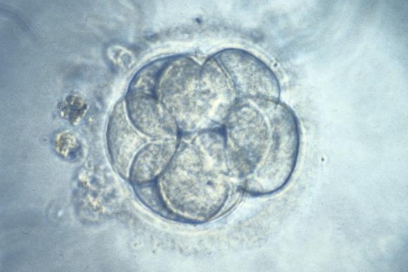 Menschliches Embryo im Labor.